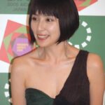 奥菜恵が難病を公表！マイケル・ジャクソンさんらも悩んだ「尋常性白斑」