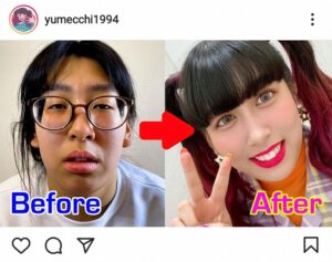 整形を告白「大幅な顔のアップデートをしました」3時のヒロイン・ゆめっちが、