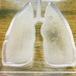 たばこを吸う「肺皿」は肺が溶けて、